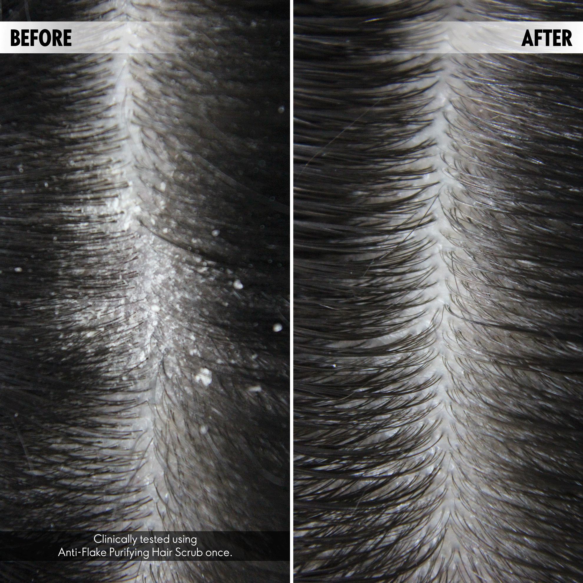 lähedalt võetud foto juuste väljalangemisest