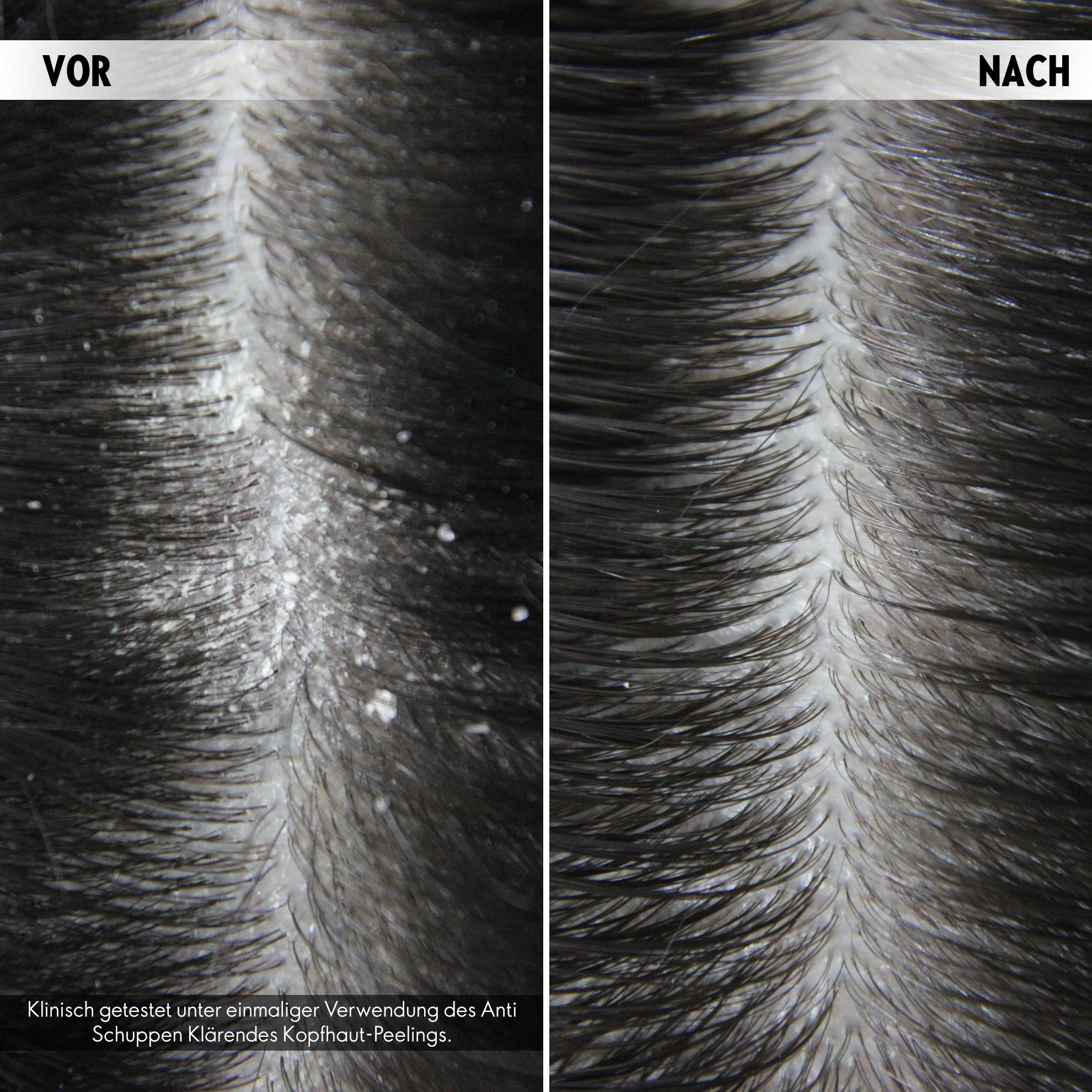 Nahaufnahme von Haaren