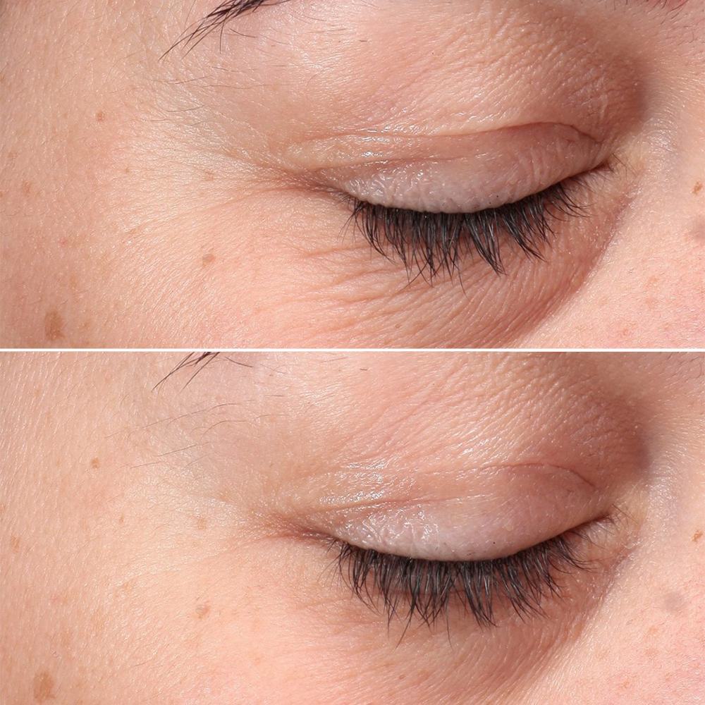 približek oči osebe